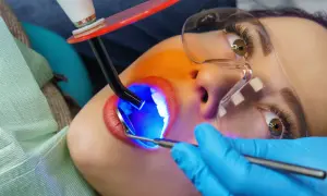 Zabieg lakowania zębów uśmiechniętej pacjentki. Dentysta używa lampy polimeryzacyjnej do utwardzenia materiału.