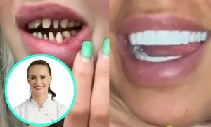 Przed i po: nieudane tureckie zęby, powikłania po zabiegu, a obok uśmiechnięta dentystka.