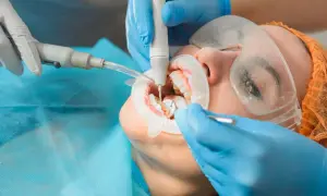 Dentysta wykonuje zabieg higienizacji jamy ustnej. Zastanawiasz się, ile trwa higienizacja? Zazwyczaj około godziny.