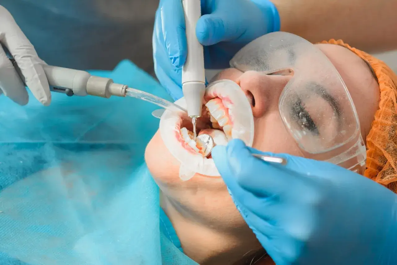 Dentysta wykonuje zabieg higienizacji jamy ustnej. Zastanawiasz się, ile trwa higienizacja? Zazwyczaj około godziny.
