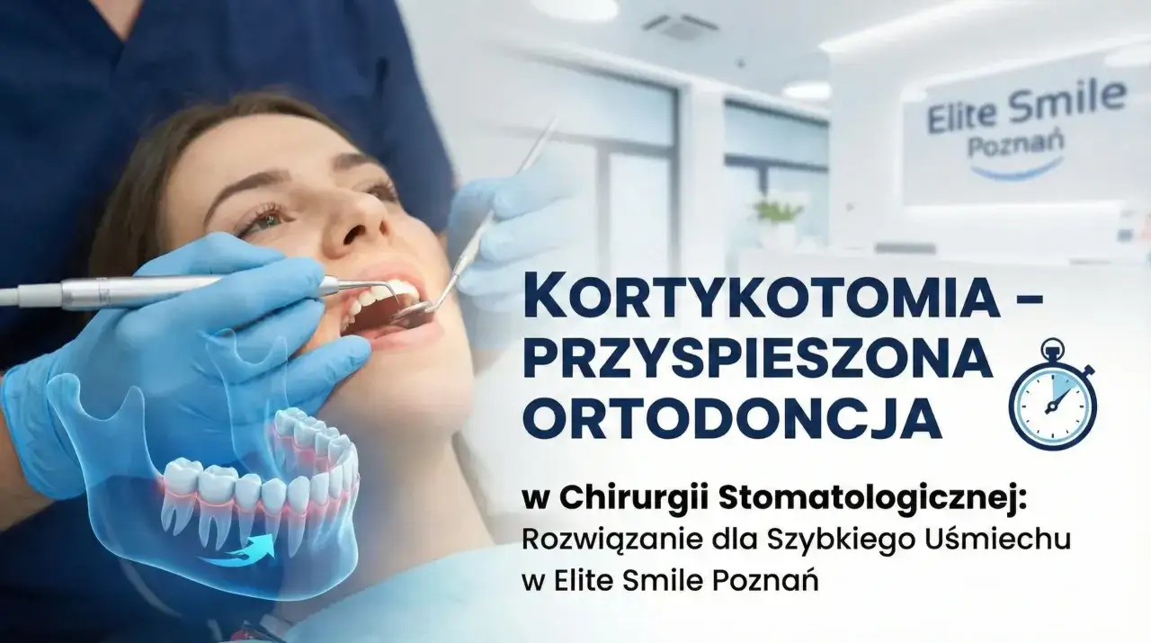 Kortykotomia przyspiesza ortodoncję. Zabieg w Elite Smile Poznań dla szybkiego uśmiechu.